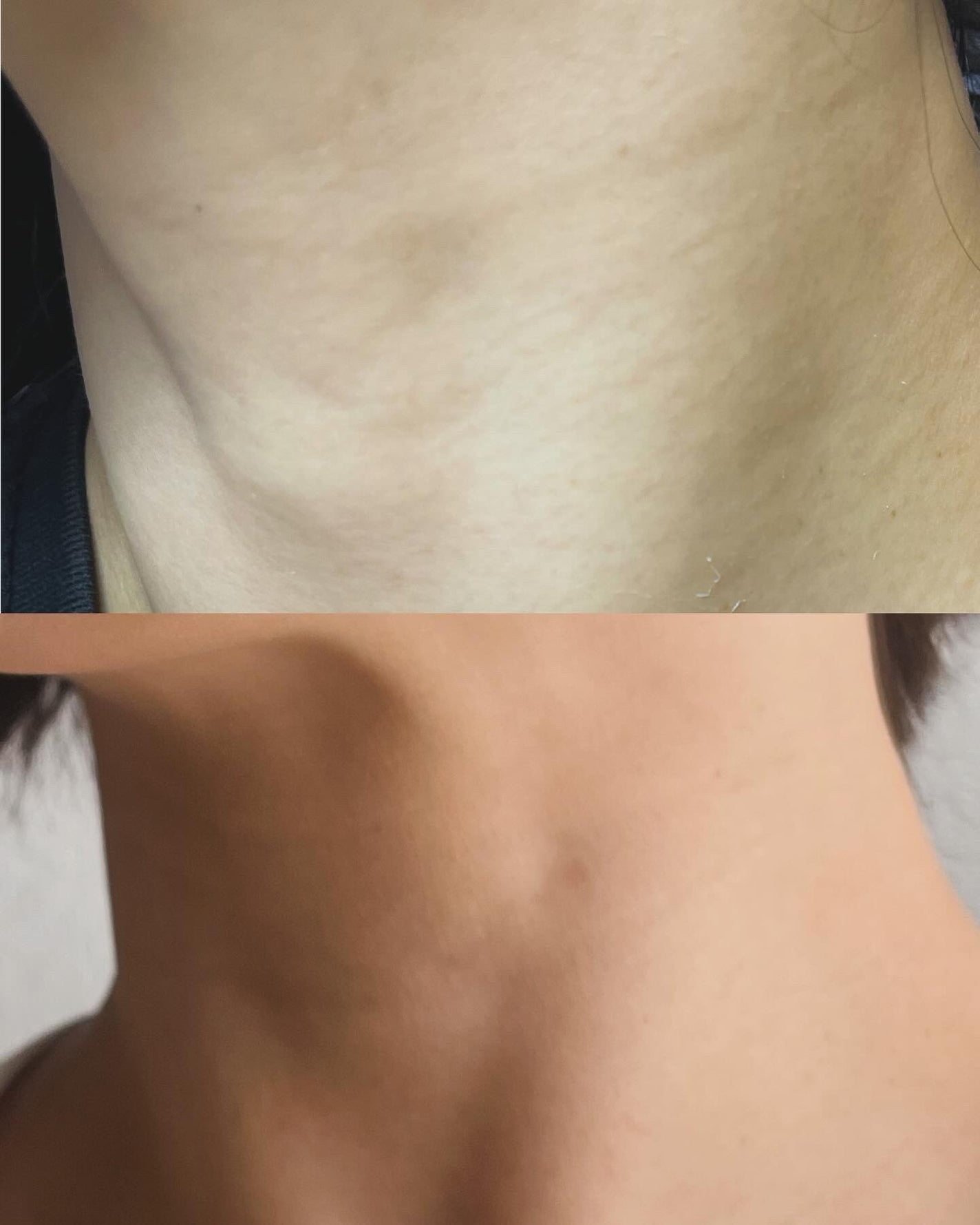 薬用美白WHITE+AIDe/Nalelu(ナレル)/フェイスクリームを使ったクチコミ(2枚目)