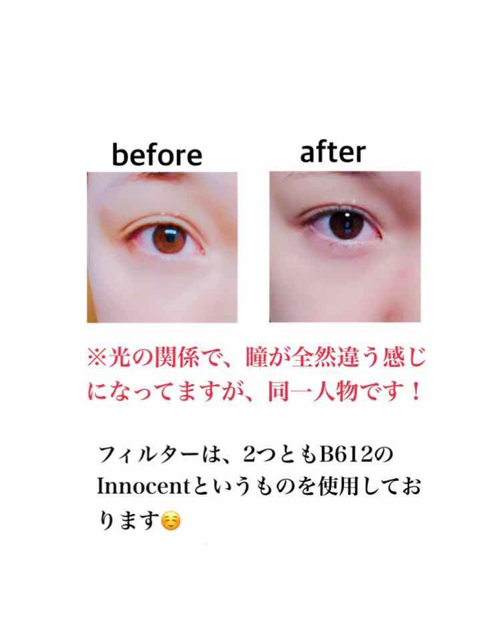 ローヤルゼリー配合 栄養ローション/DAISO/美容液を使ったクチコミ(2枚目)