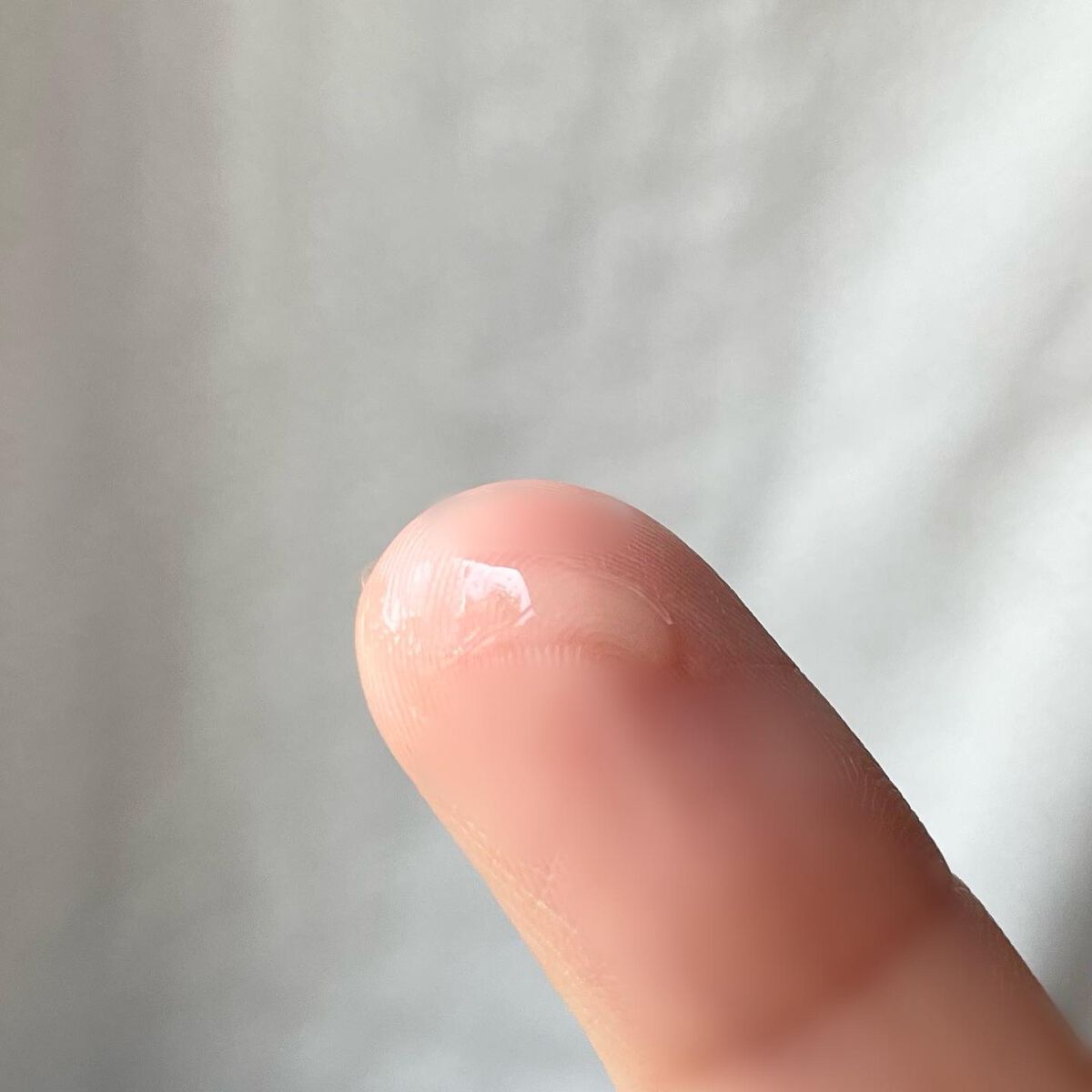 ニキビあとケアジェル/アットノン/その他スキンケアを使ったクチコミ(3枚目)