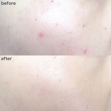 (旧)アンリミテッド ラスティング フルイド/shu uemura/リキッドファンデーションを使ったクチコミ(7枚目)