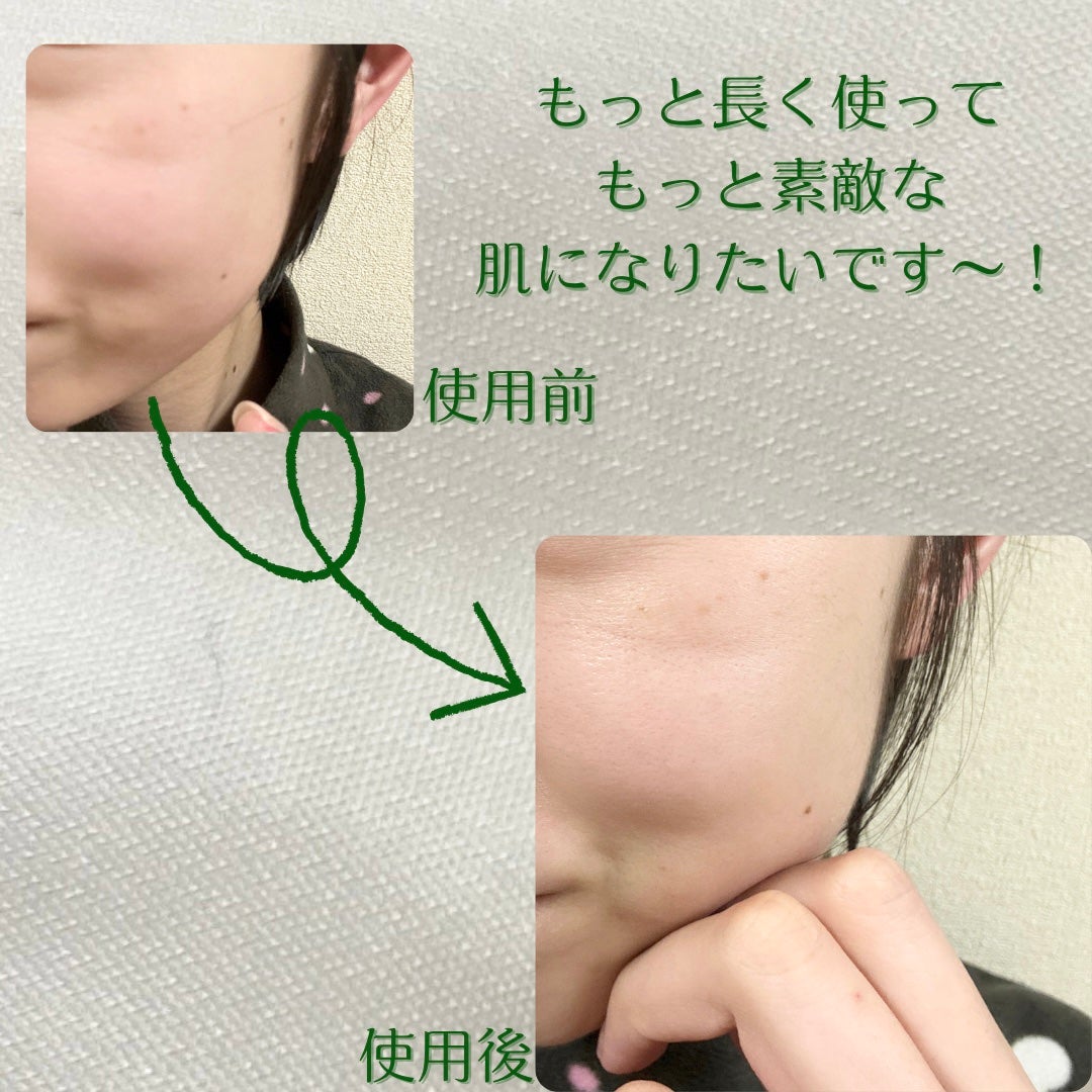 バランシング シカ ブレミッシュ セラム/Roume/美容液を使ったクチコミ(5枚目)