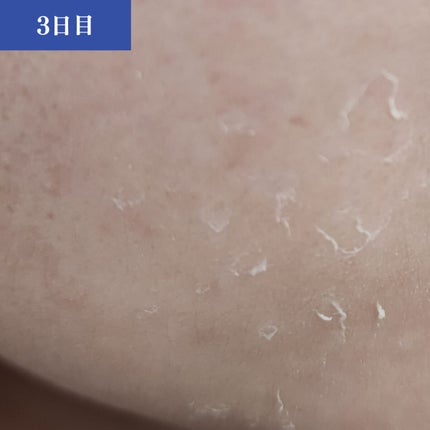 ダーマスキンピーリング/BQCELL/その他キットセットを使ったクチコミ(3枚目)