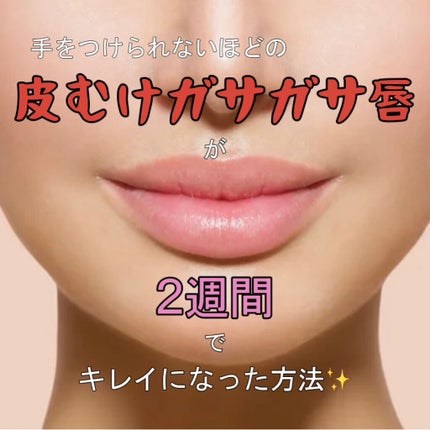 ニベア ディープモイスチャーリップ/ニベア/リップクリームを使ったクチコミ(1枚目)