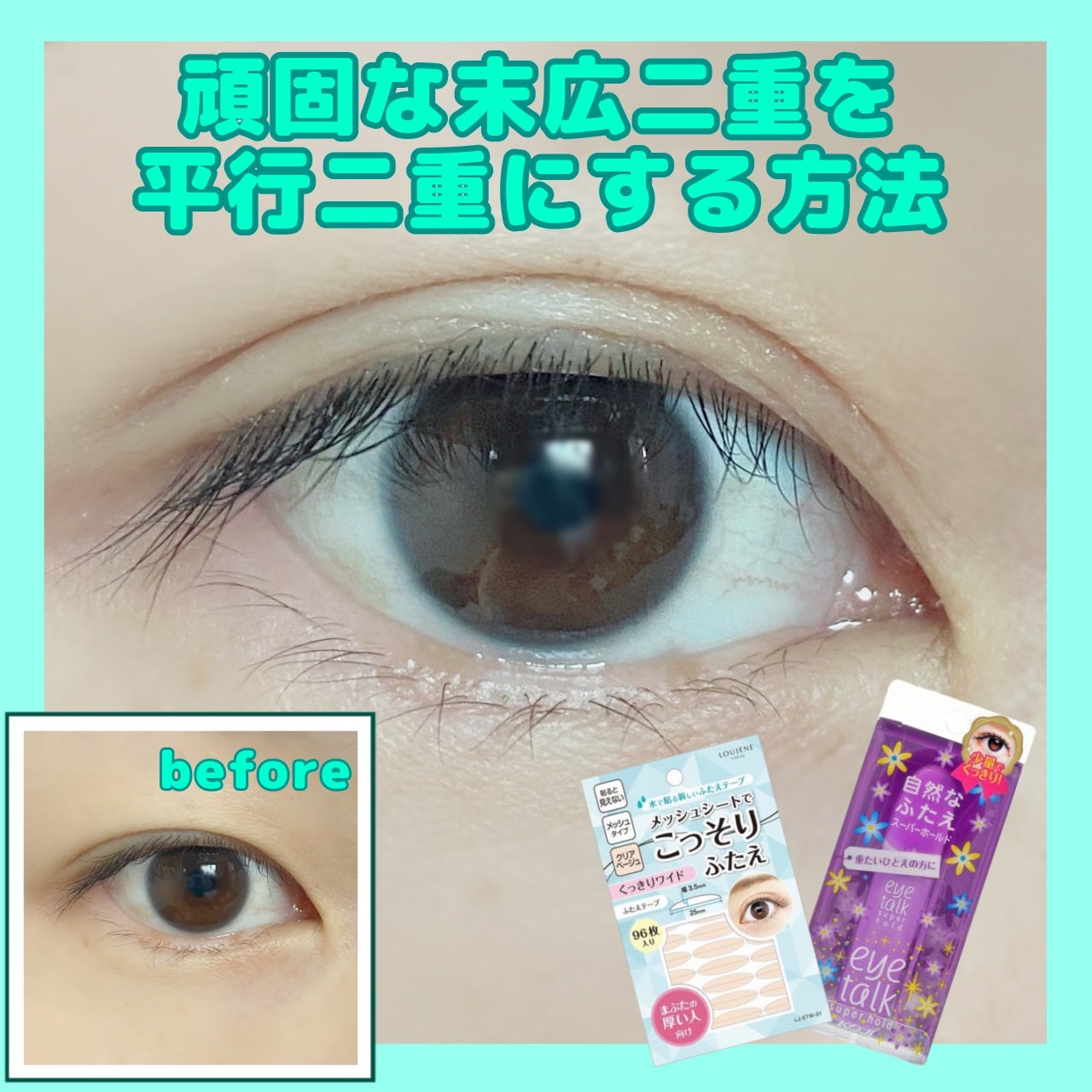 アイトーク スーパーホールド/アイトーク/二重まぶた用アイテムを使ったクチコミ(1枚目)