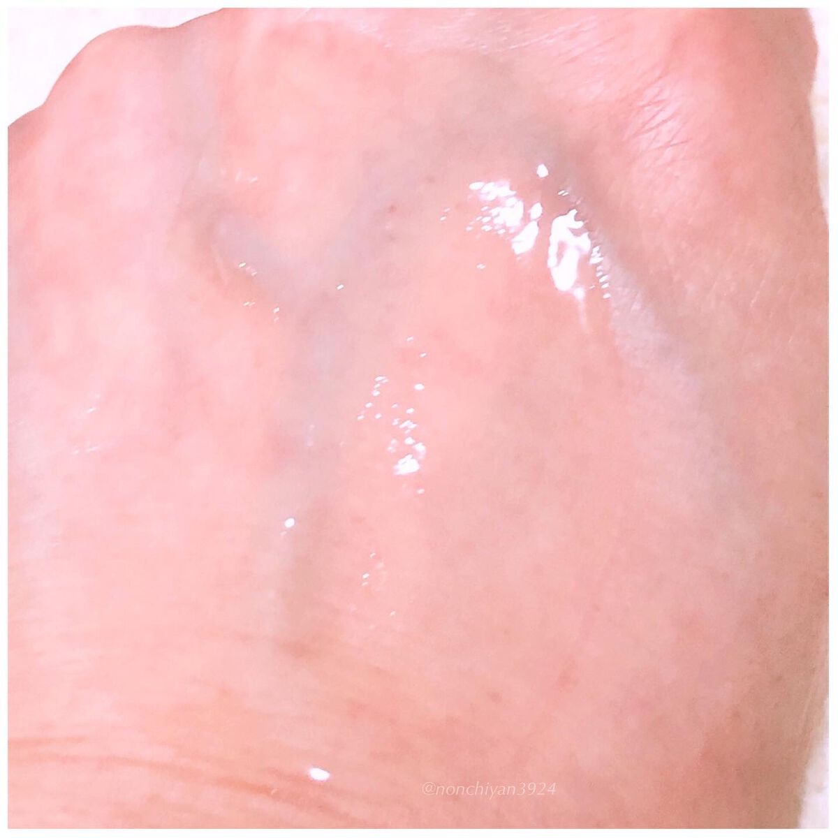 REJURAN ターンオーバーアンプル/REJURAN COSMETICS/美容液を使ったクチコミ(5枚目)