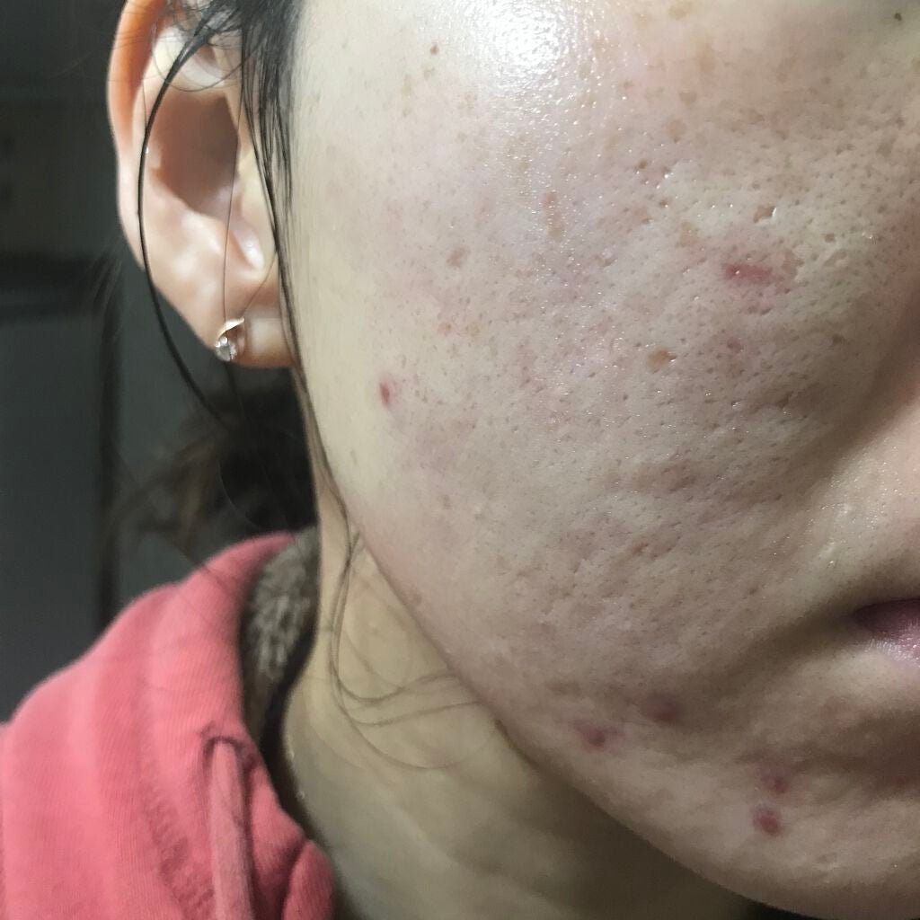 ビオオイル アルガンオイル/Melvita/フェイスオイルを使ったクチコミ(2枚目)