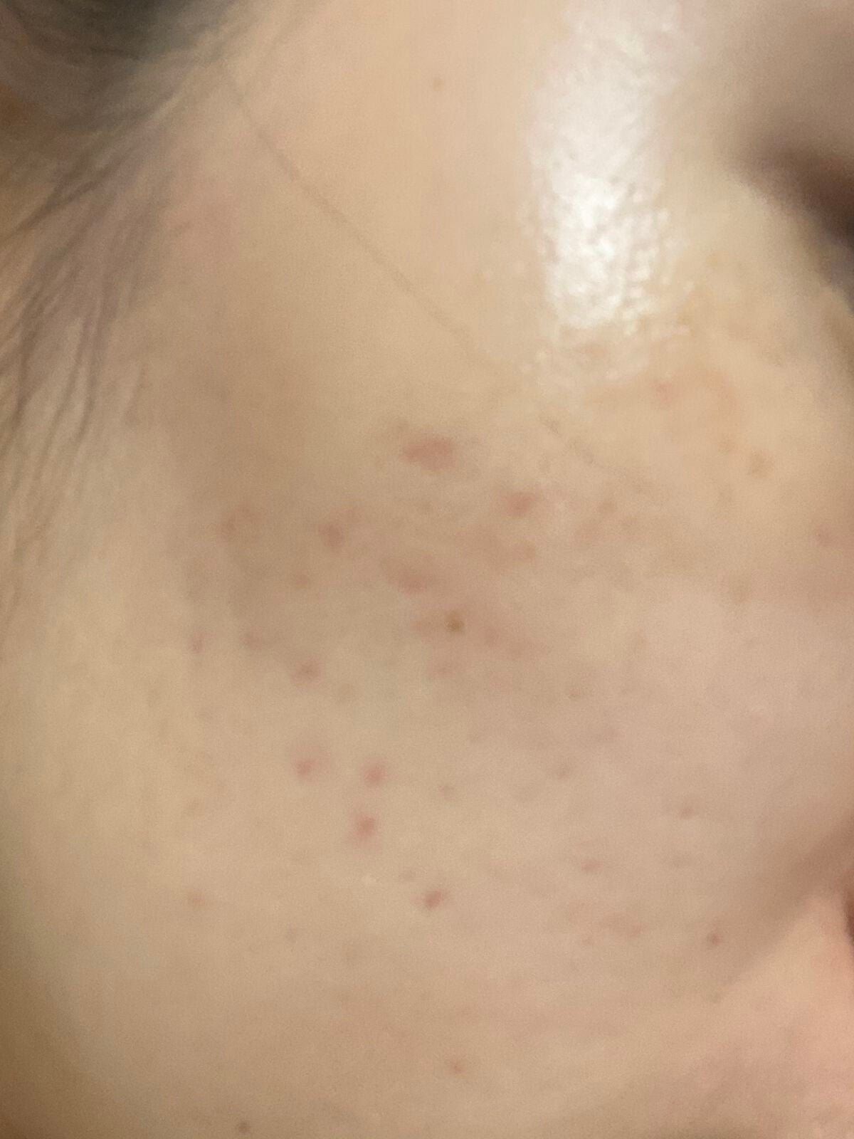 AGE-Rダーマエアショット/MEDICUBE/美顔器・マッサージを使ったクチコミ(4枚目)