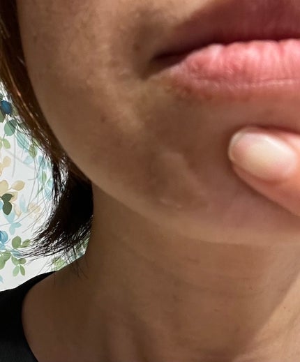 を使ったクチコミ(1枚目)