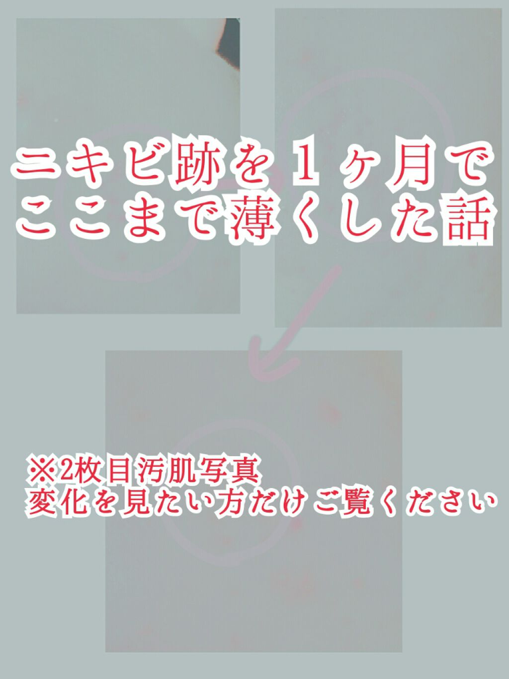 敏感肌用薬用美白美容液/無印良品/美容液を使ったクチコミ(1枚目)