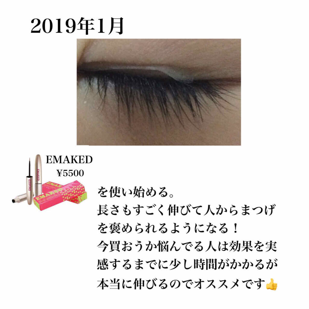 オリジナル ピュアスキンジェリー/ヴァセリン/ボディクリームを使ったクチコミ（3枚目）