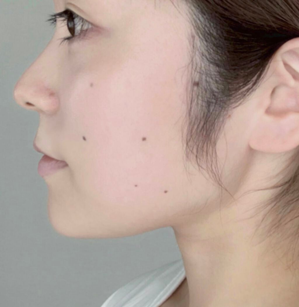 ディオールスキン フォーエヴァー グロウ クッション/Dior/クッションファンデーションを使ったクチコミ(4枚目)