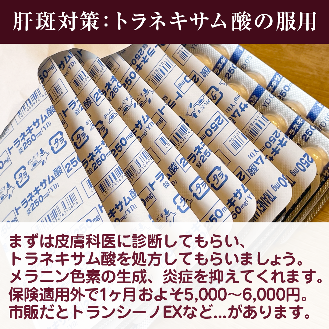 ðððððžãã©ããð¯ on LIPS ãå®ã¯ãã®ã·ãèæããïŒãç§ã®èæå¯Ÿçãã玹ä»ããŸã+*ïŸïœ¡*..ãïŒ3æç®ïŒ