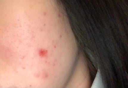 グリーンティーシード セラム/innisfree/美容液を使ったクチコミ(3枚目)