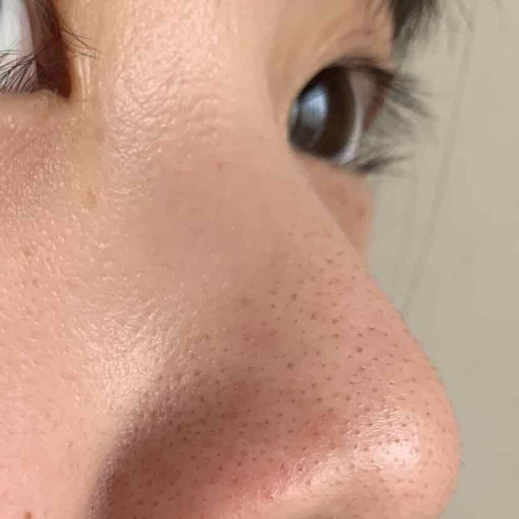 さやぁ on LIPS 「みなさんこんにちは!汚い写真を見せてしまい申し訳ないです🙇♀..」(3枚目)