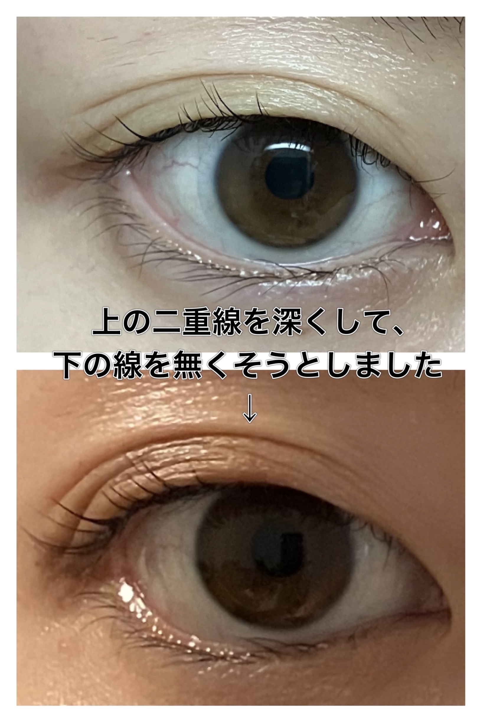 TWOOL ダブルアイリッドグルー ダブルアイリッドグルー 接着タイプ/SHOBIDO/二重まぶた用アイテムを使ったクチコミ（3枚目）