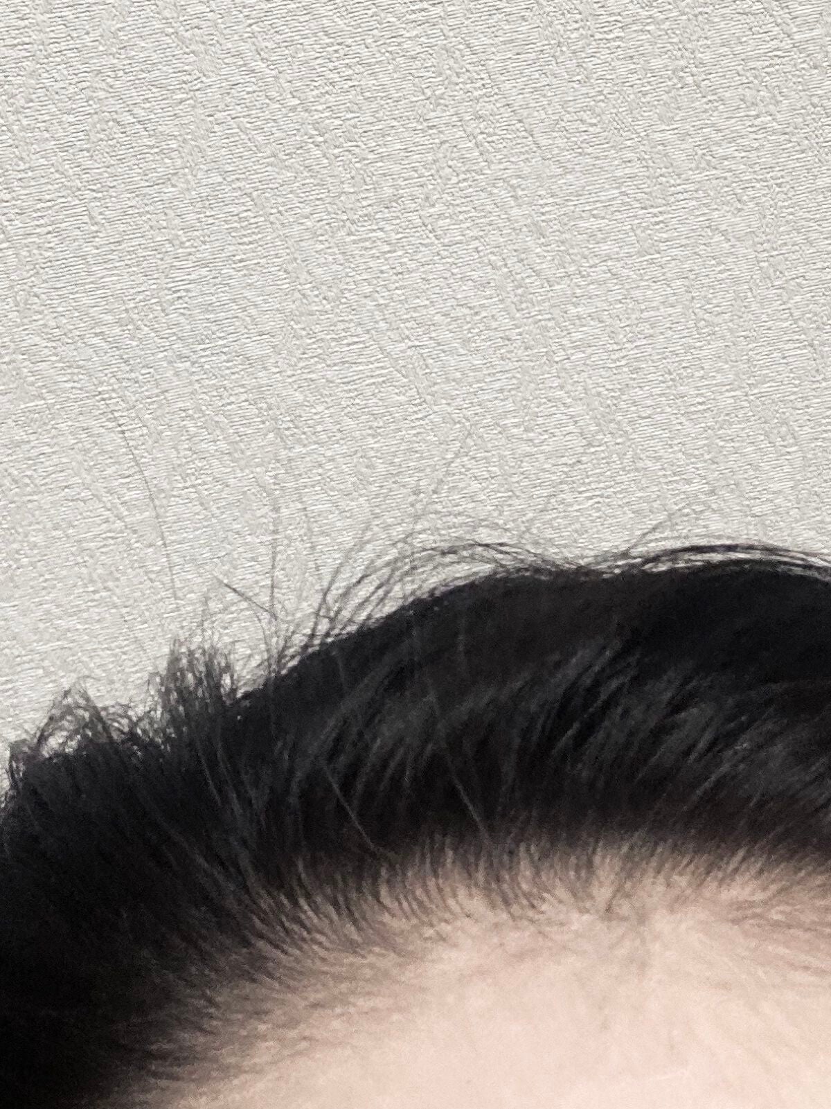 ヘアアクセルレーターEX フローラルアップルの香り/加美乃素本舗/頭皮ローションを使ったクチコミ(4枚目)