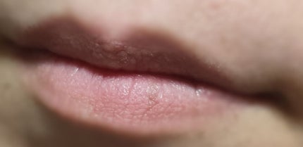 リップケア バーム/キュレル/リップバームを使ったクチコミ(3枚目)