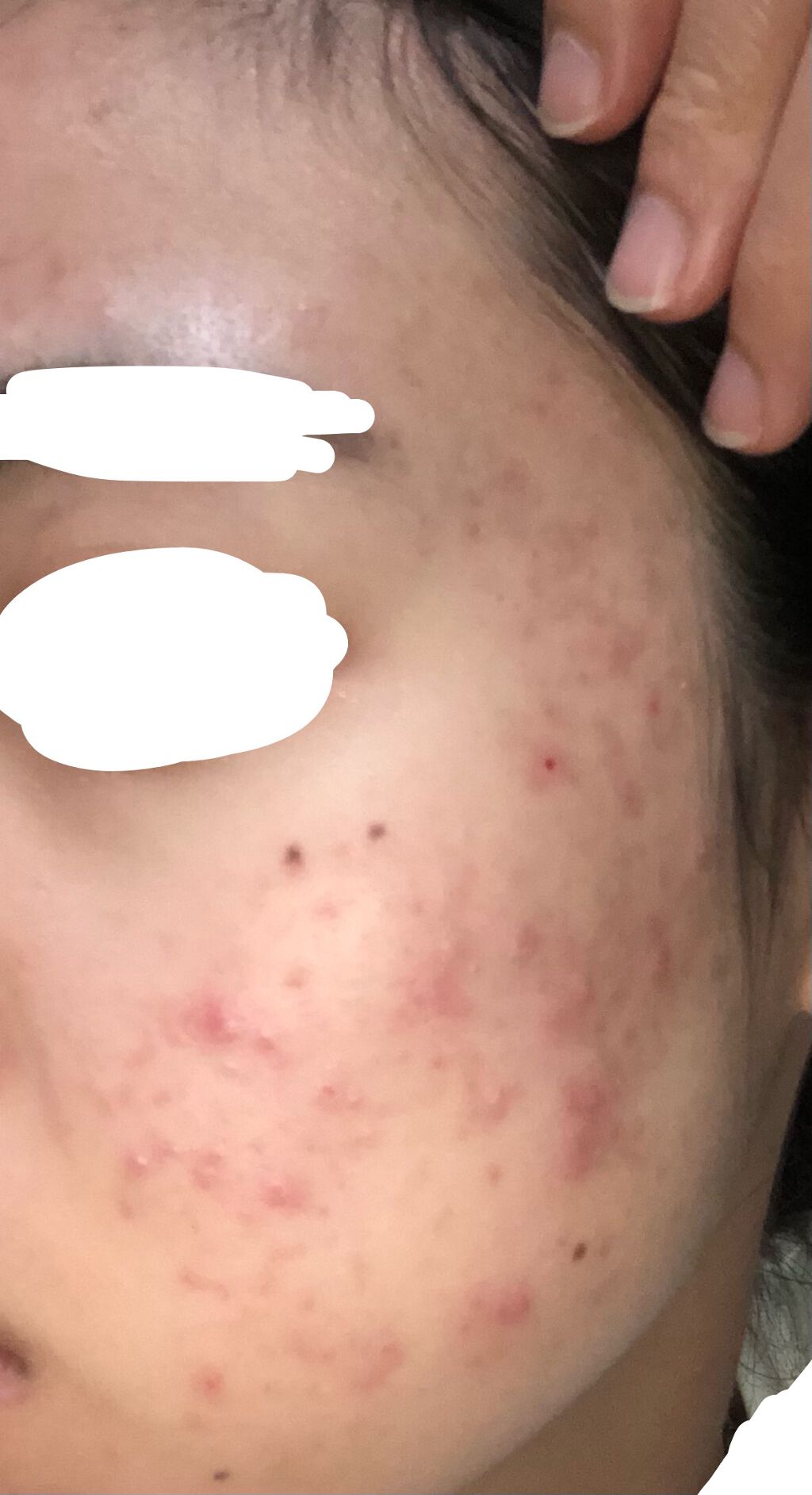 デュオ ザ クレンジングバーム/DUO/クレンジングバームを使ったクチコミ(2枚目)