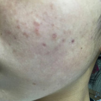 を使ったクチコミ(2枚目)