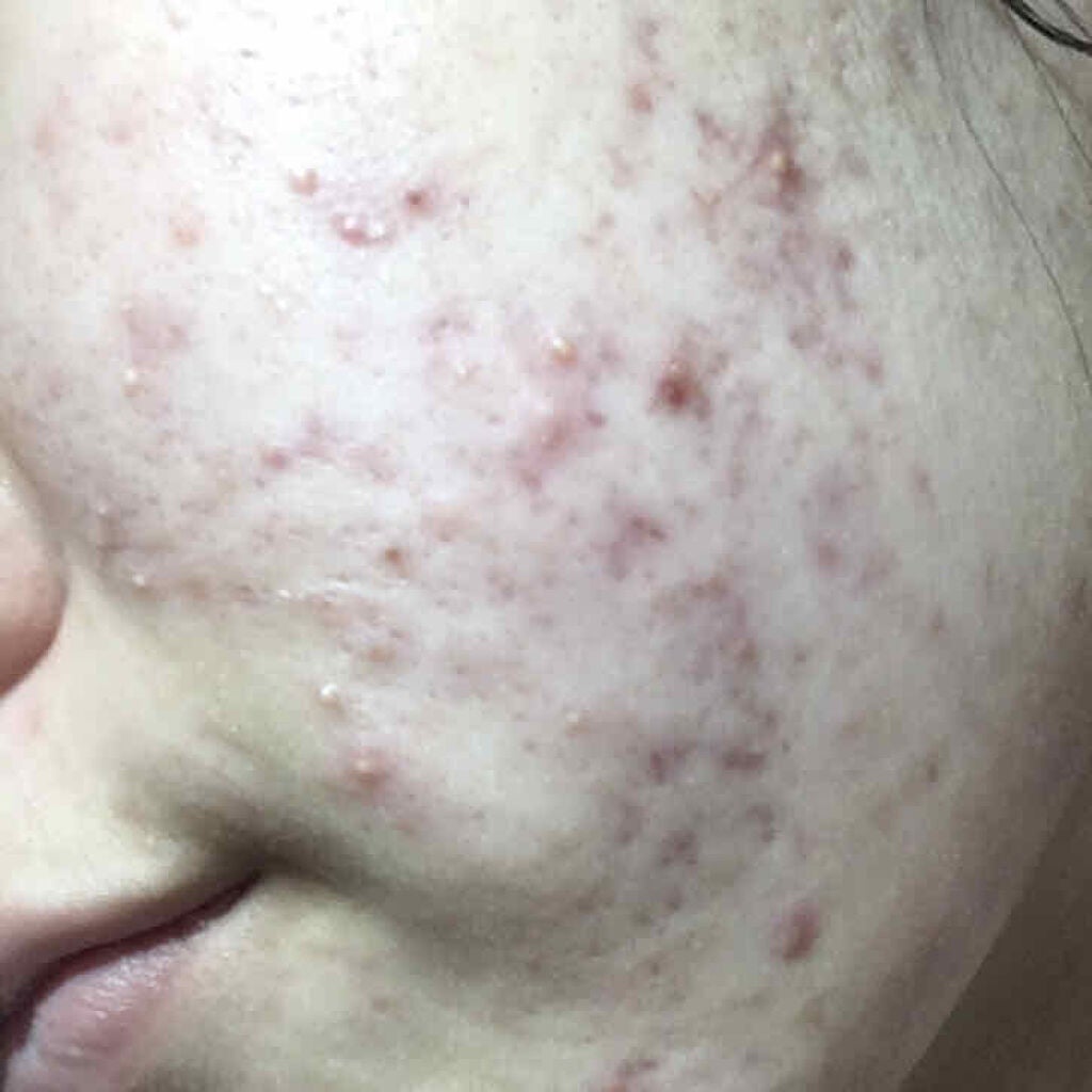 åå±é£¯ð on LIPS ããé²èŠ§æ³šæããããèæ¹åèšé²ãèšé²ãããšå幎ã§è綺éºã«ããŸãäž..ãïŒ2æç®ïŒ