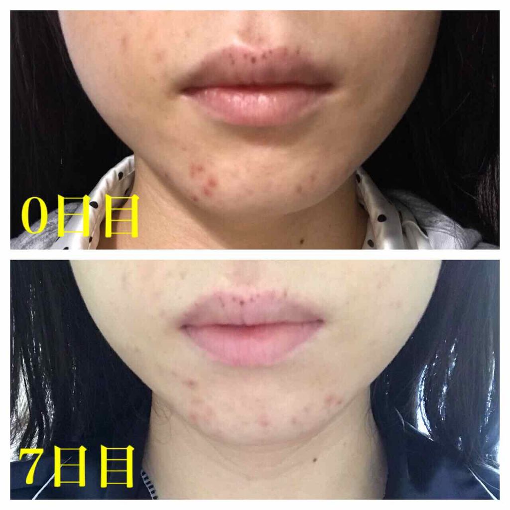 ファイバーフォーム/ルナメアAC/洗顔フォームを使ったクチコミ(4枚目)