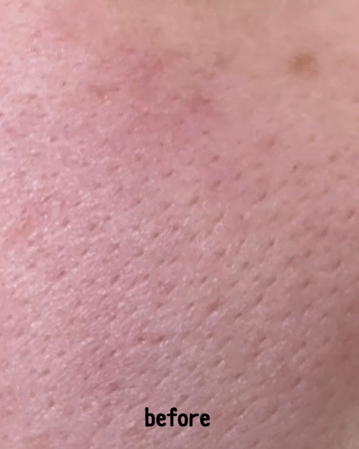 レチノール　シカ　リペア　セラム 【旧】30mL/innisfree/美容液を使ったクチコミ（2枚目）