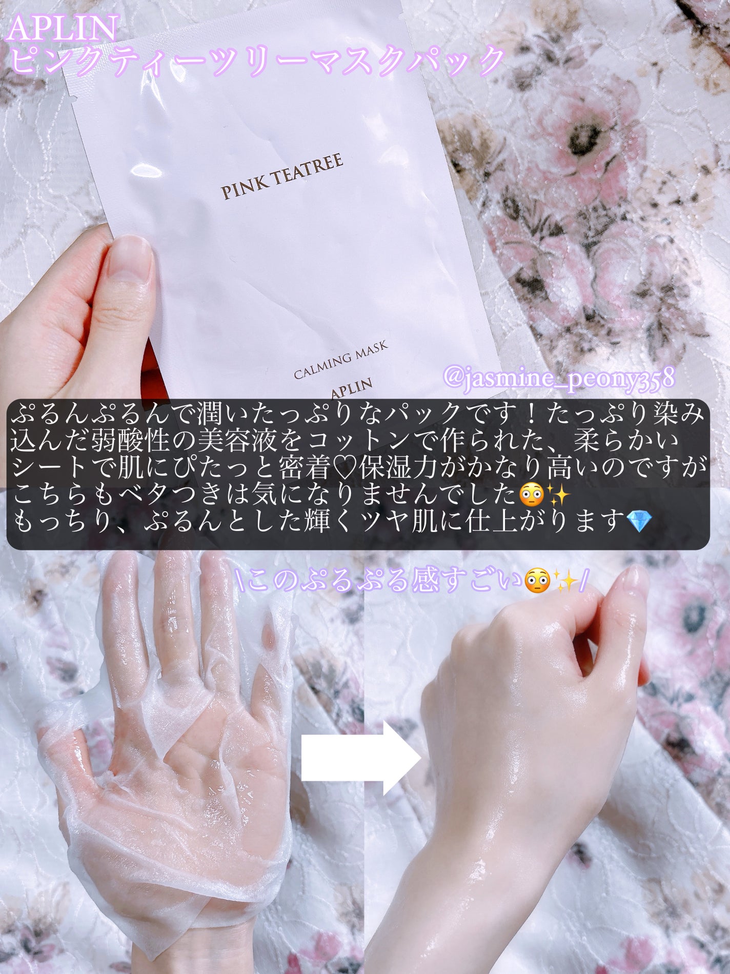 ピンクティーツリートナー/APLIN/化粧水を使ったクチコミ(3枚目)