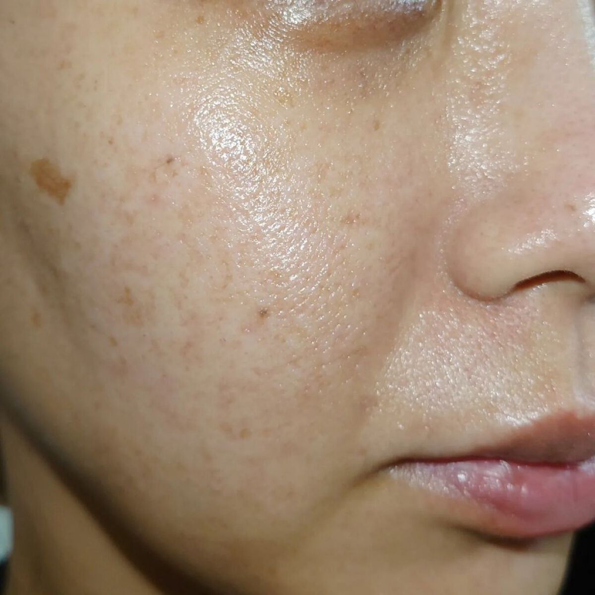 フルフィットプロポリスライトアンプル/COSRX/美容液を使ったクチコミ(7枚目)