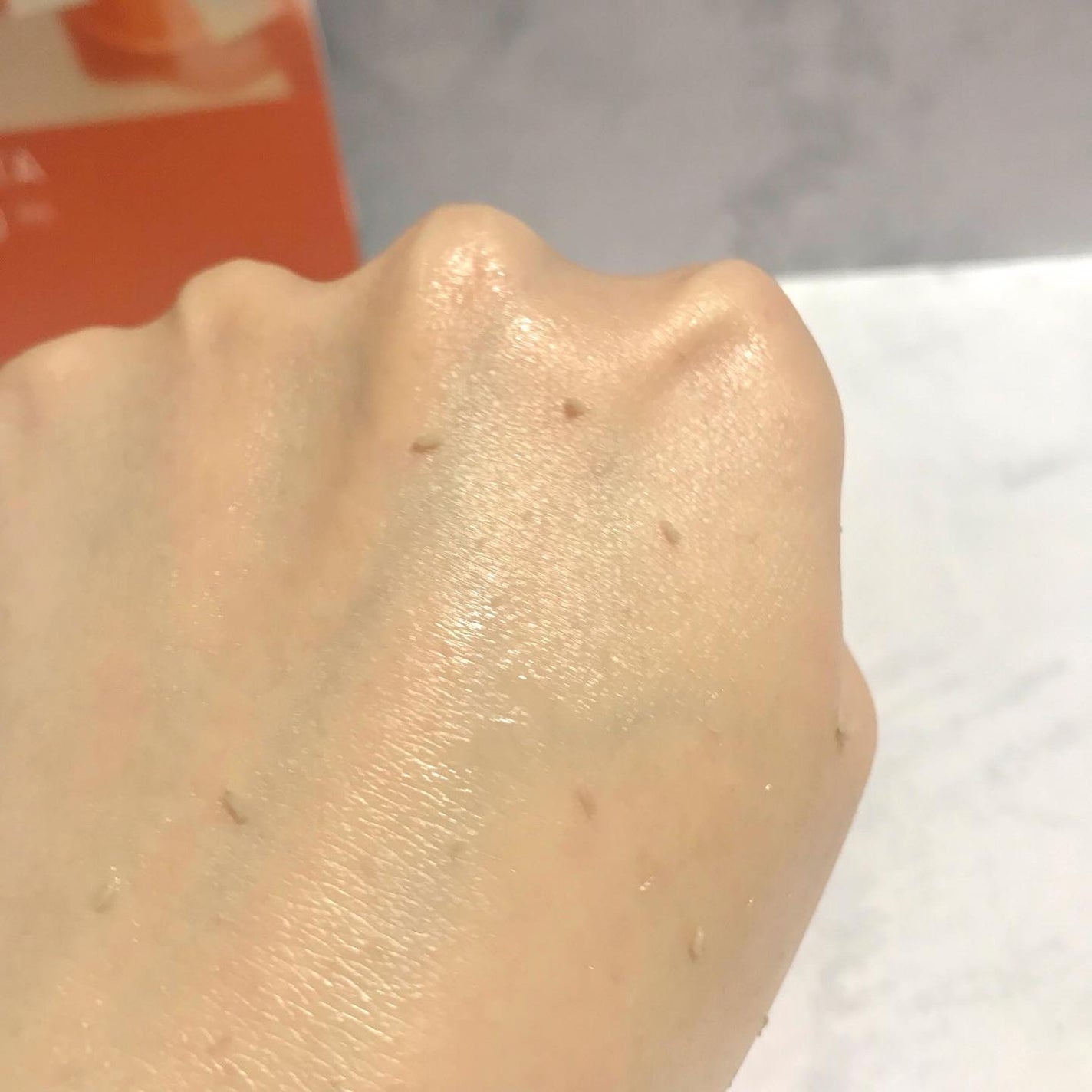 薬用アクネ角質ケアジェル/NIKI PITA/ピーリングを使ったクチコミ(5枚目)