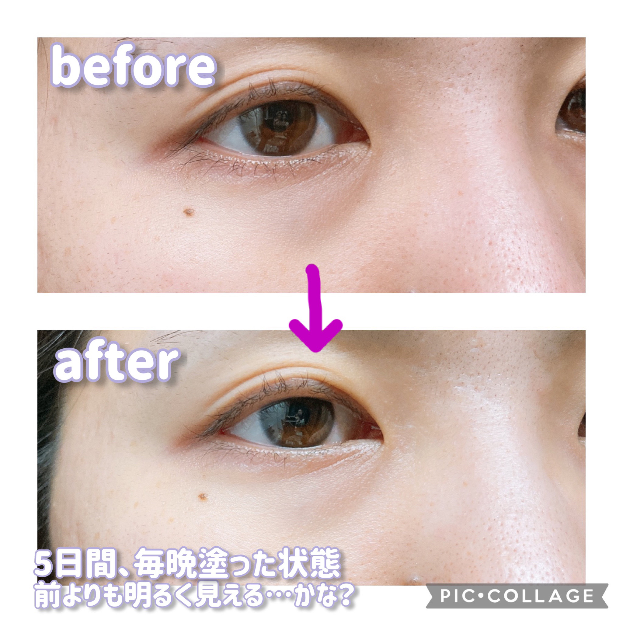 オーバーナイトアイクリーム P.M｜OOTD Beautyの口コミ - 目元のクマ