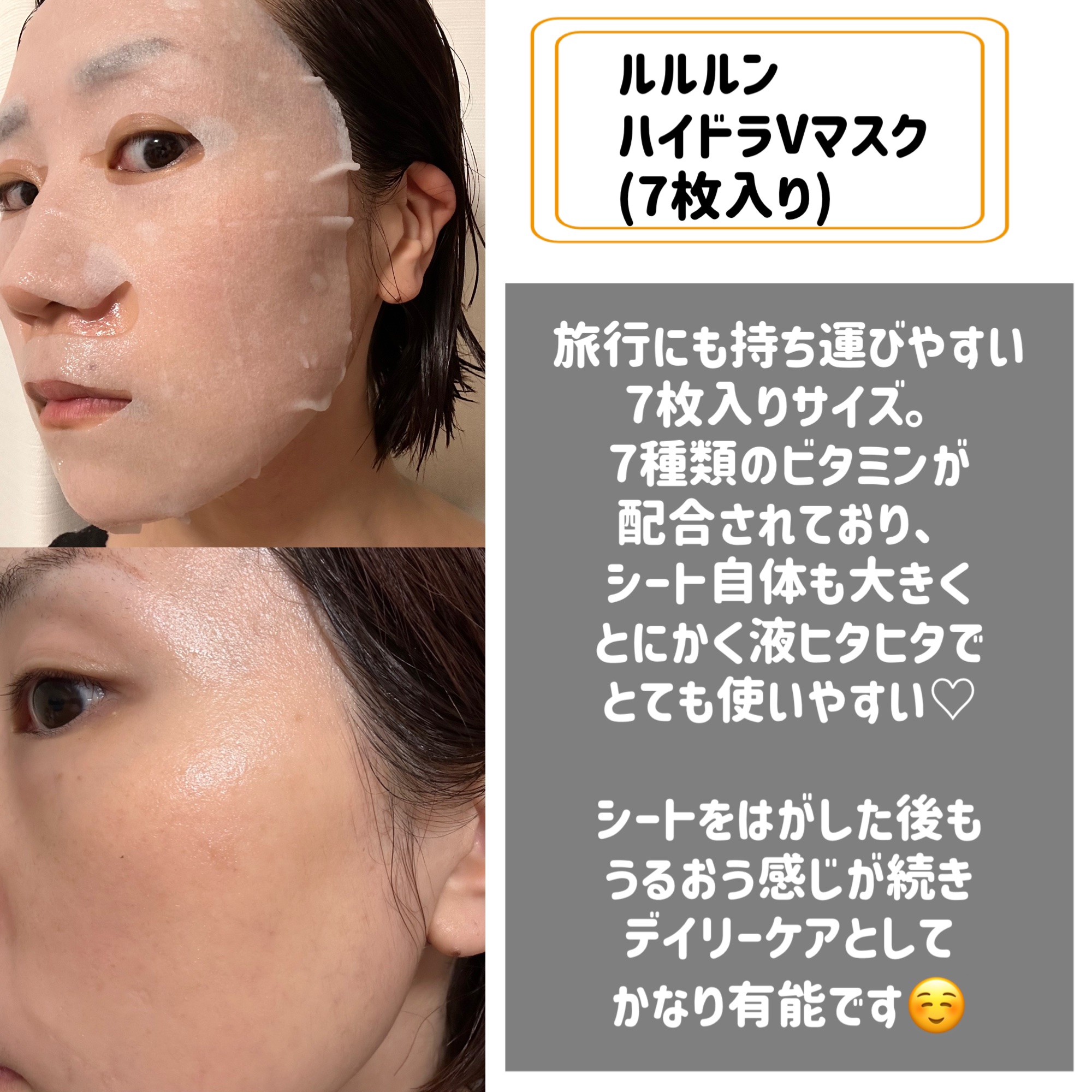 ルルルン ハイドラ V マスク/ルルルン/シートマスク・パックを使ったクチコミ（2枚目）