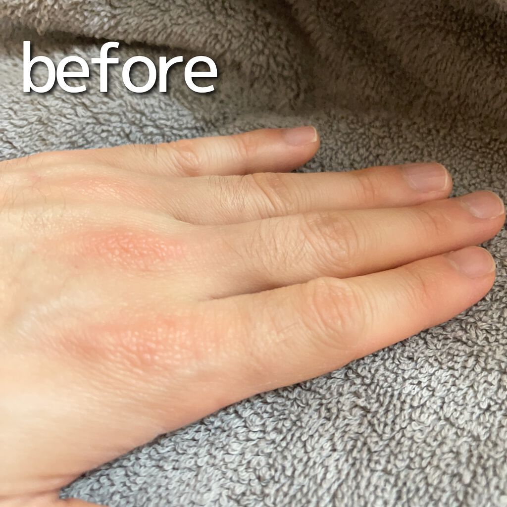 NONON/NONON(ノンノン)/除毛クリームを使ったクチコミ（3枚目）