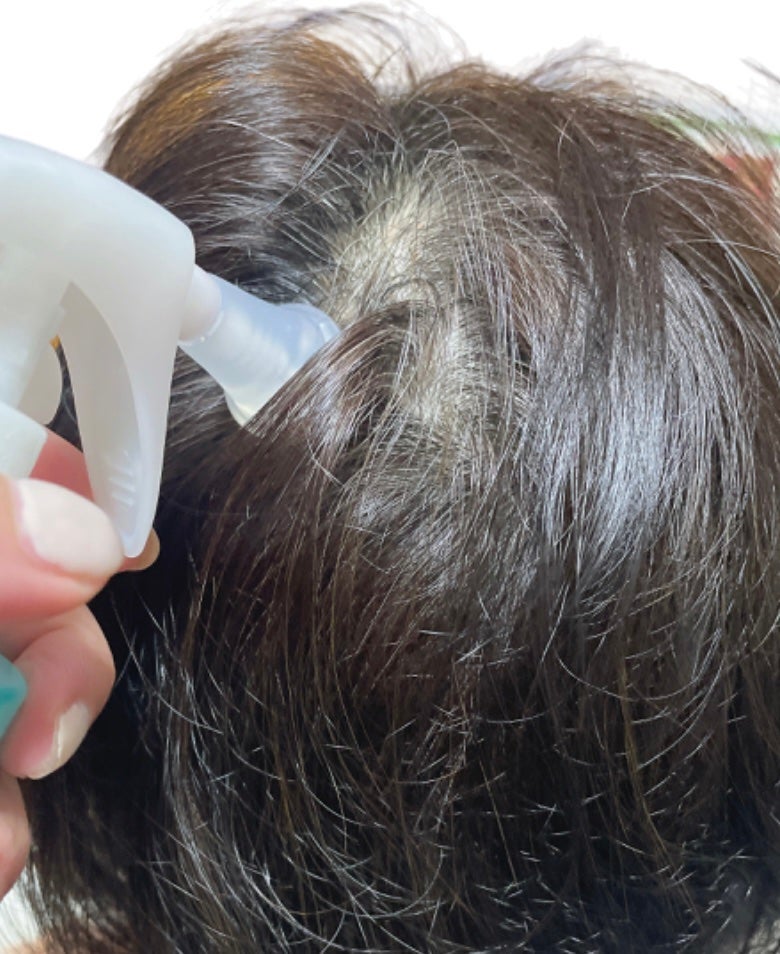 スペシャルケアセット(スキャルプパッチ/育毛トニック)/fasa/頭皮ローションを使ったクチコミ(6枚目)