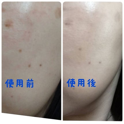 ヴィー スティックウェルファンデーション/ビアント/化粧下地を使ったクチコミ(4枚目)