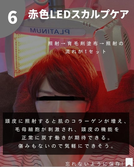 FR02ローション/フォリックス/頭皮ローションを使ったクチコミ(8枚目)