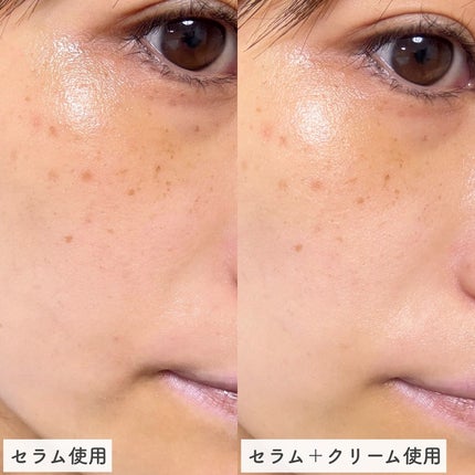 バイオヒールボ プロバイオダーム 3Dリフティングクリーム/BIOHEAL BOH/フェイスクリームを使ったクチコミ(7枚目)