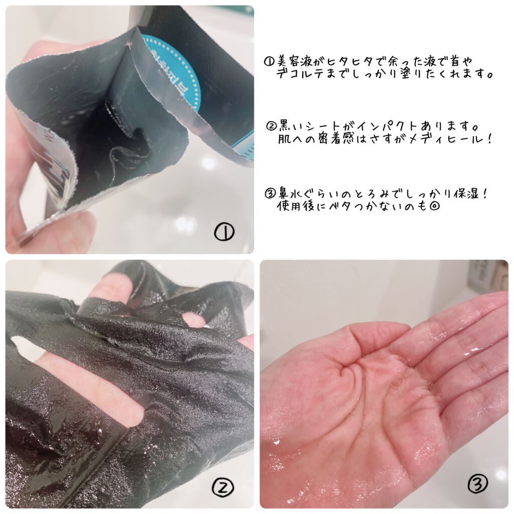 W.H.P ブラックマスク JEX/MEDIHEAL/シートマスク・パックを使ったクチコミ(2枚目)