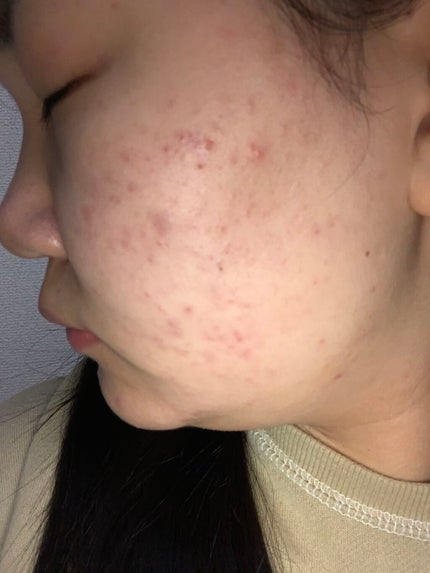 導入化粧液/無印良品/ブースター・導入液を使ったクチコミ(3枚目)