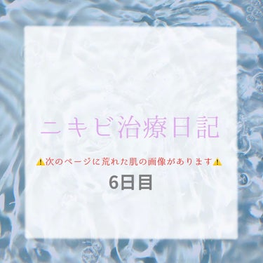 みみ on LIPS 「【6日目】わりと落ち着いてきた気がする！（気がする）汁もほぼ出..」（1枚目）