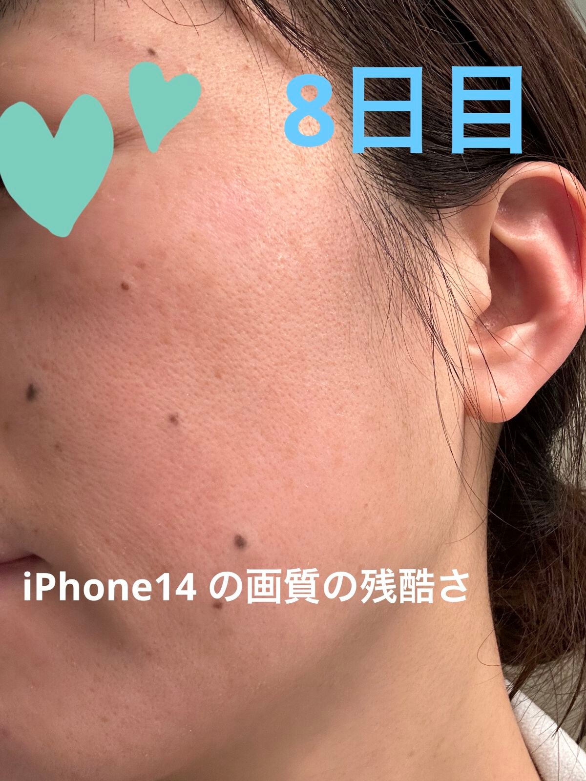 ゼオ美さん on LIPS 「ゼオスキン マイルドコース8日目夜☆バランサートナー☆デイリー..」(2枚目)