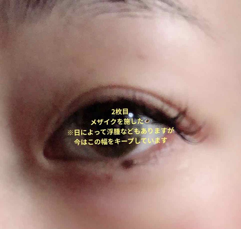 メザイク クリップ カッター ファイバー専用カッター/メザイク/二重まぶた用アイテムを使ったクチコミ(3枚目)