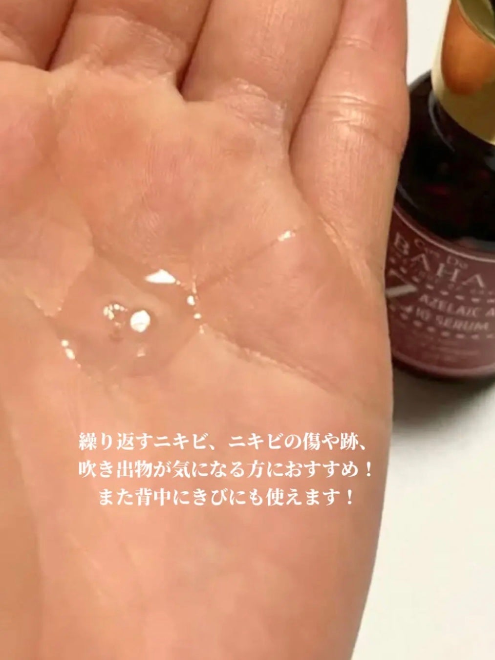 AZアゼライン酸10セラム/コスデバハ/美容液を使ったクチコミ(3枚目)