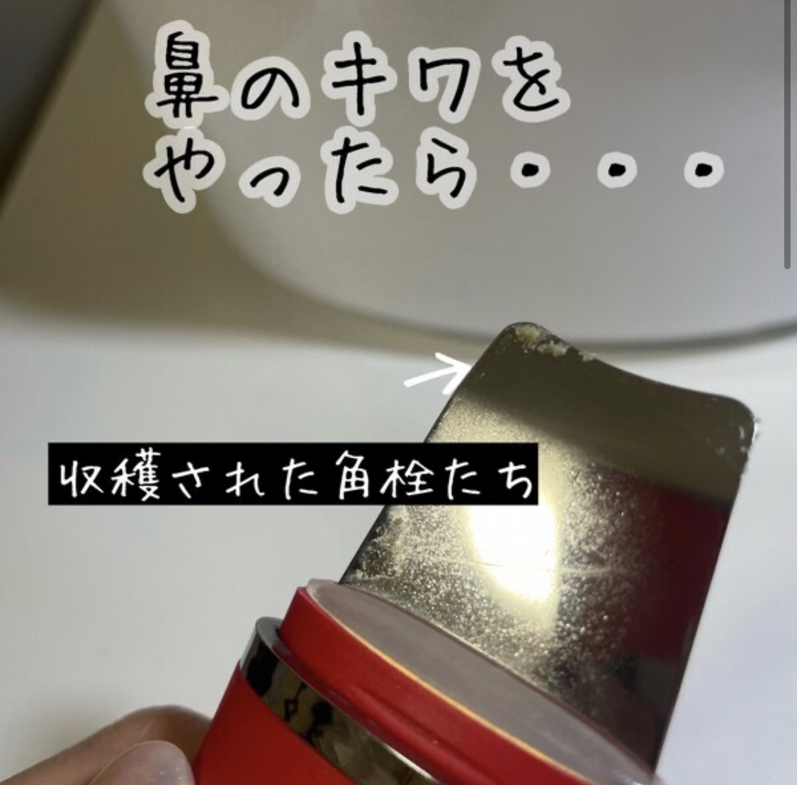 ウォーターピーリング超音波美顔器/ANLAN/美顔器・マッサージを使ったクチコミ（3枚目）