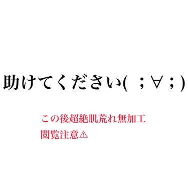 ラーメンちゃん on LIPS 「助けてください、、。肌荒れが止まりません。皮膚科にも行っていま..」（1枚目）