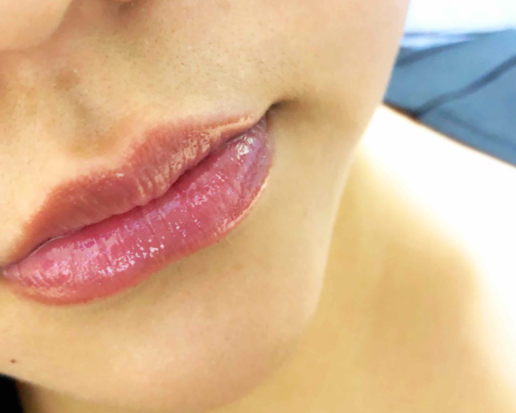 【旧】ディオール アディクト リップ マキシマイザー/Dior/リップグロスを使ったクチコミ（3枚目）