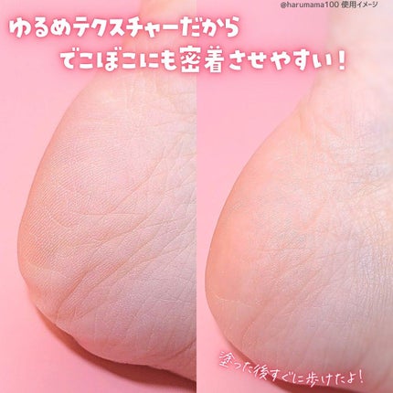 足小路麗子 薬用 フットケアジェル/ナリスアップ/レッグ・フットケアを使ったクチコミ(4枚目)