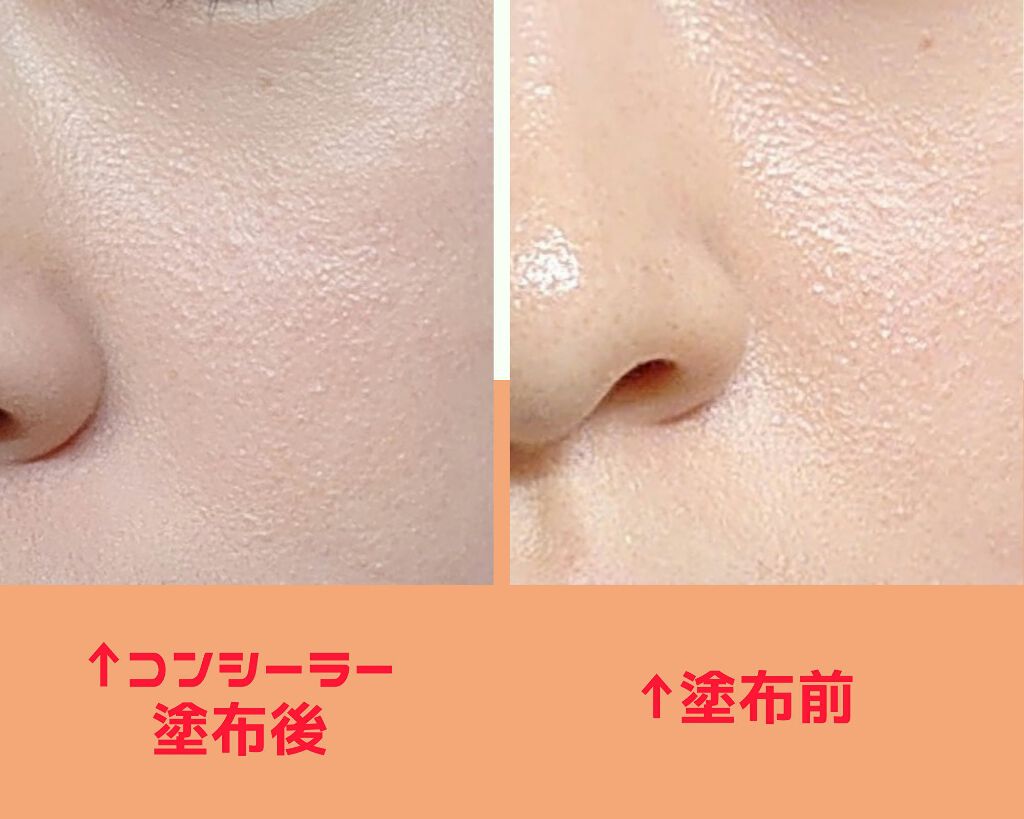 フィットミー コンシーラー/MAYBELLINE NEW YORK/リキッドコンシーラーを使ったクチコミ(2枚目)