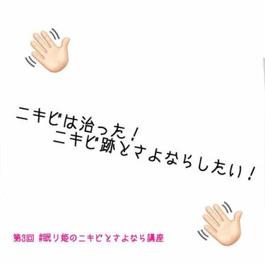 🐾 #眠り姫のニキビとさよなら講座 🐾

第三回は〜ニキビは治った！ニキビ跡とさよならしたい！〜 です。

第三回が遅くなってしまいすみません🙇🏻
コンサートに行く準備や女の子の月1血祭りパーティーに参