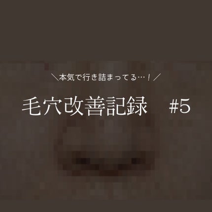 バブルガード/シャボン玉石けん/ハンドソープを使ったクチコミ(1枚目)