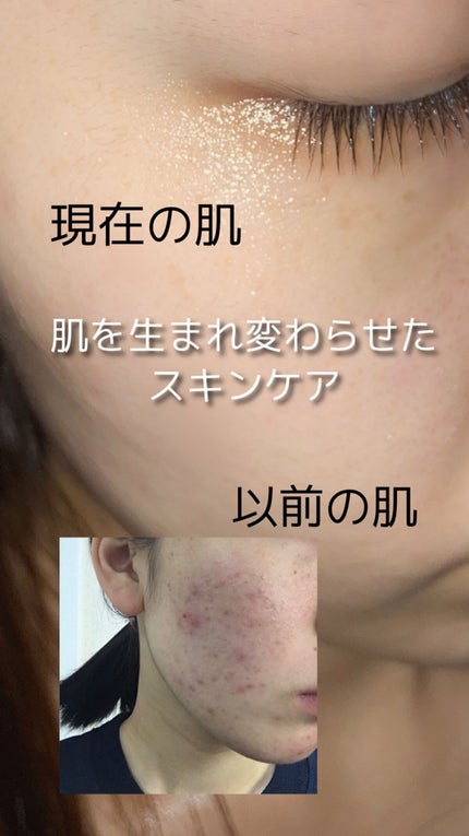 化粧水・敏感肌用・高保湿タイプ/無印良品/化粧水を使ったクチコミ(1枚目)